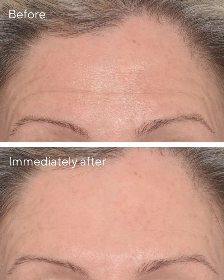 Murad Targeted Wrinkle Corrector Treatment