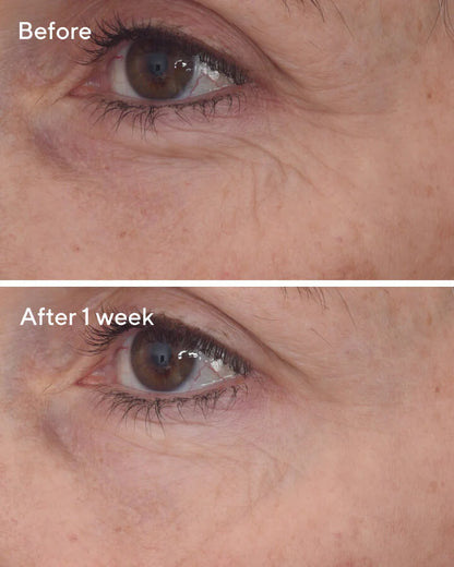 Murad Retinal ReSculpt Eye Lift Treatment