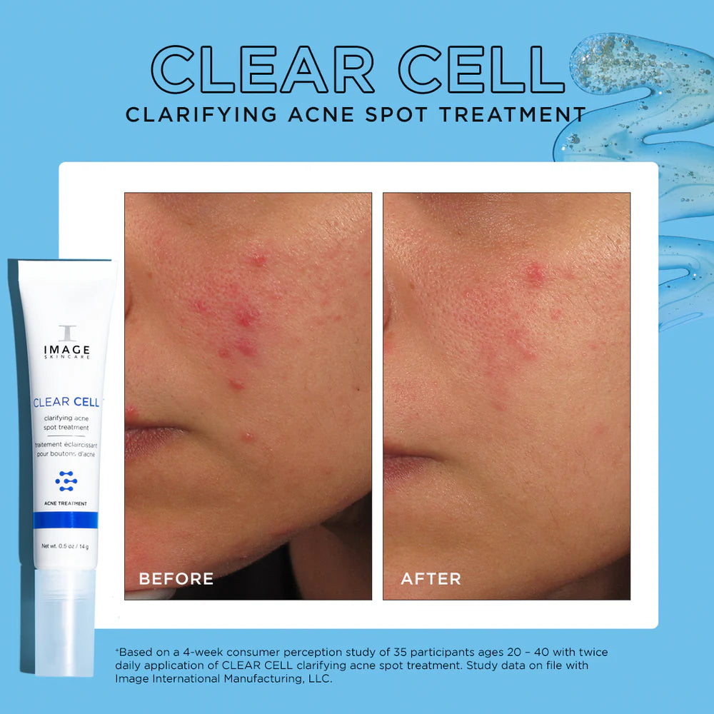 IMAGE Clear Cell Clarifying Acne Spot Treatment